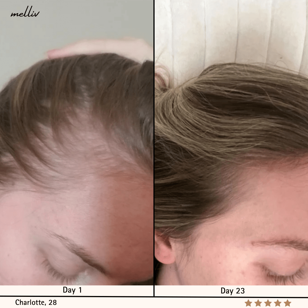 Shampooing Oignon & Biotine Melliv - My Store