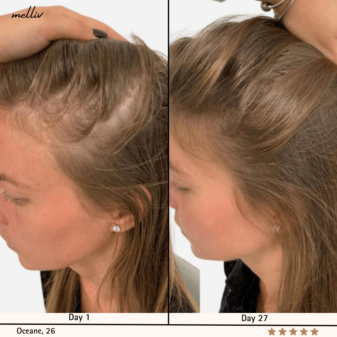 Shampooing Oignon & Biotine Melliv - My Store