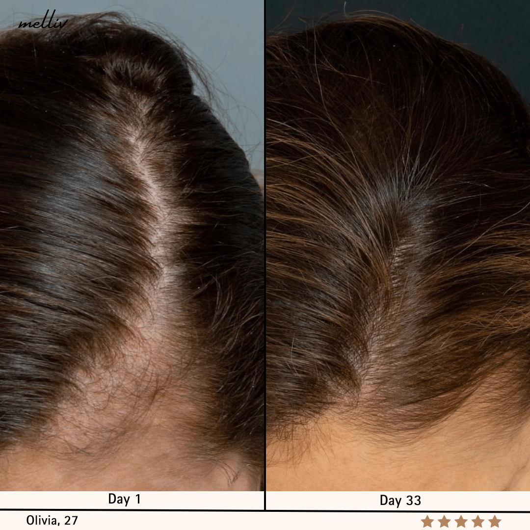 Shampooing Oignon & Biotine Melliv - My Store