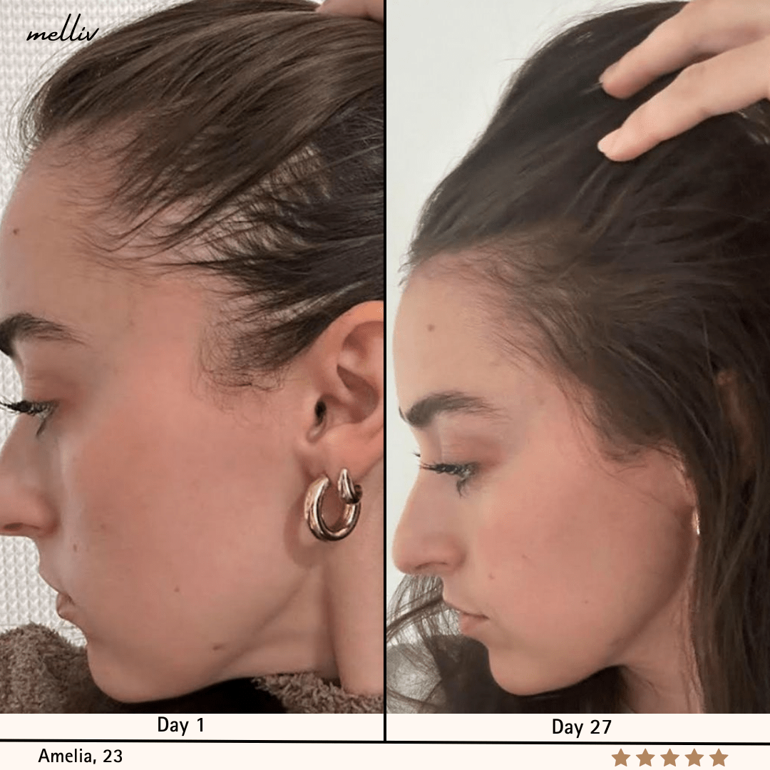Shampooing Oignon & Biotine Melliv - My Store